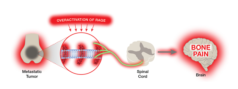 rage overactivation in bone pain